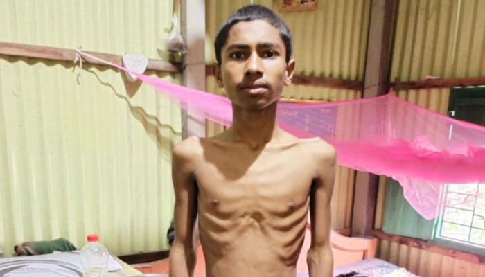 মরণঘাতী ক্যান্সার থেকে বাঁচতে চায় কিশোর মঞ্জু