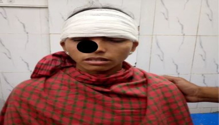 হবিগঞ্জের চুনারুঘাটে উবাহাটা গ্রামে পুত্র বধু কে কুপিয়ে আহত হয়েছে শশুর বাড়ির লোকজন 