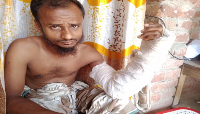 পার্বতীপুরের পল্লীতে তুচ্ছ ঘটনায় রাজমিস্ত্রী আশরাফুলের দু'হাতের কবজি ভেঙ্গে দিয়েছে সন্ত্রাসী শাহ আলম, মামলা প্রস্তুতি