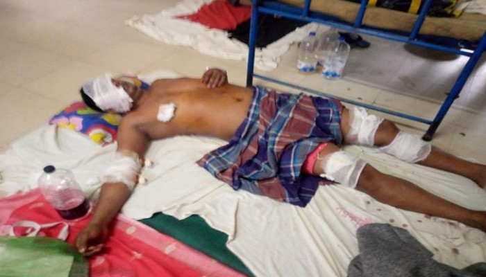 শাহাজীর বাজার গ্যাসফিল্ডে বন্যপ্রাণীর হামলায় আনসার সদস্য আহত