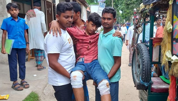 শেরপুরে অটোরিকশা উল্টে ৪ পরীক্ষার্থীসহ আহত ৬