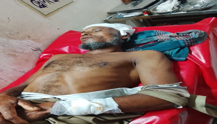 মুলাদীর কাজিরচরে চাই পেতে মাছ ধরাকে কেন্দ্র করে একজনকে পিটিয়ে গুরুতর আহত।​