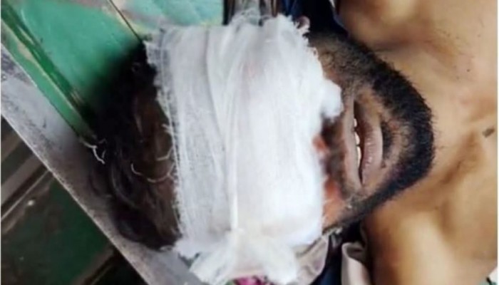 জাজিরায় মাদক ব্যাবসায়ী দ্বারা চোখ তোলে ফেলার অভিযোগ।