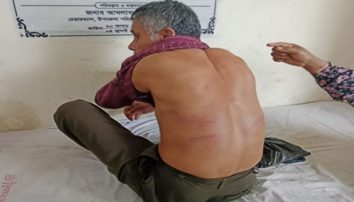 বুড়িচংয়ে ক্লান্ত হয়ে চেয়ারে বসায় বৃদ্ধ পাহারাদারকে পিটিয়ে আহত করলেন যুবদল নেতা