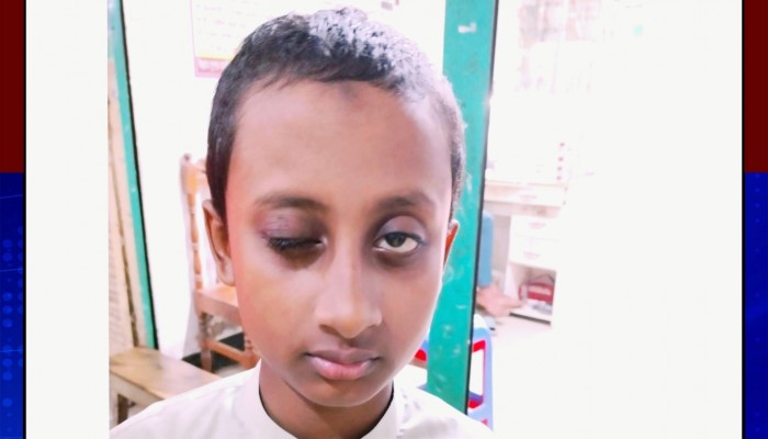 গাজীপুর শ্রীপুরে শিক্ষকের পিটুনিতে অন্ধ মাদরাসা ছাত্র!