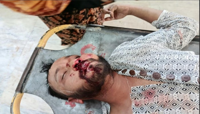 রাজশাহী নগরীতে যুবককে পিটিয়ে জখম, থানায় অভিযোগ