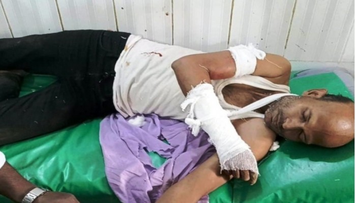 চাপাতি হামলায় গুরুতর আহত সাংবাদিক লুৎফুজ্জামান