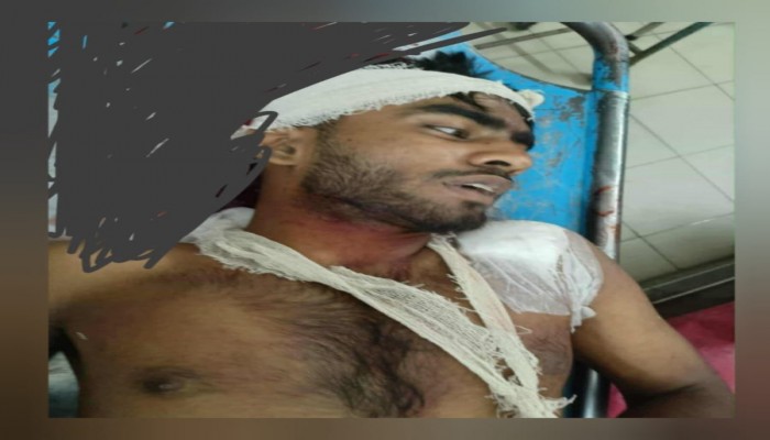 কুমারখালীতে মাদকের টাকা কম দেওয়া নিয়ে দ্বন্দ্ব, স্কুলছাত্রকে কুপিয়ে জখম