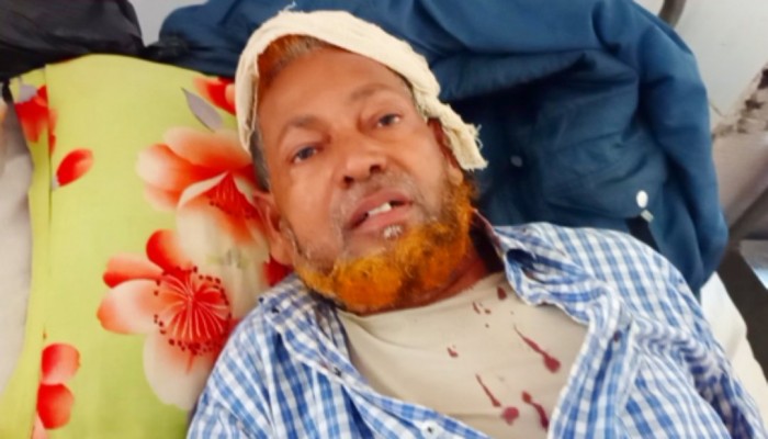 তানোরে সম্পত্তি নিয়ে বিরোধ চাচার মাথা ফাটালেন ভাতিজা