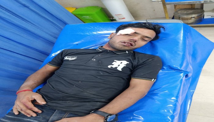 চৌগাছায় দুই মোটরসাইকেলের মুখোমুখি সংঘর্ষে আহত ৪, অবস্থা আশঙ্কাজনক