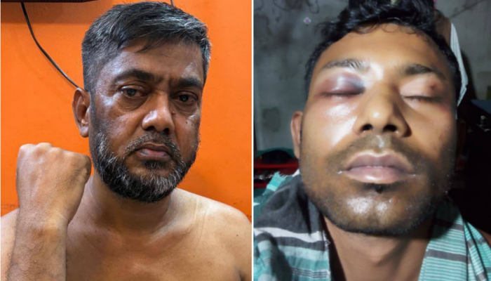 ​গৌরনদীতে আওয়ামীলীগ ও ছাত্রলীগের দুই নেতাকে পিটিয়ে আহত