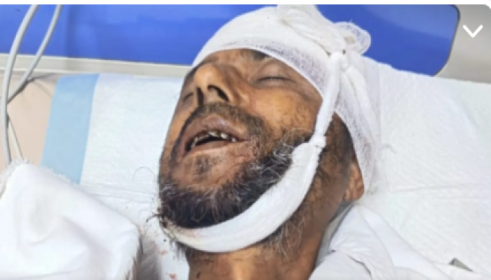 ​মাধবপুর জমি নিয়ে সালিশে দুই পক্ষের সংঘর্ষে একজনের মৃত্যু