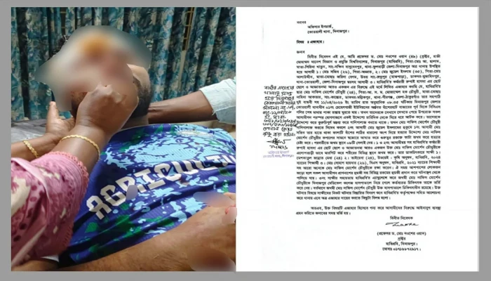 হাবিপ্রবিতে কর্মচারির হামলায় শিক্ষার্থী গুরুতর আহত