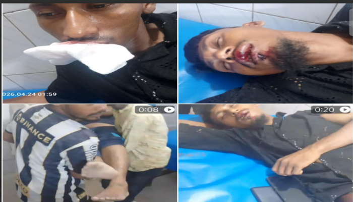 মেহেন্দীগঞ্জে জাটকা বিরোধী অভিযানে যাওয়ার পথে মৎস্য কর্মকর্তাদের ওপর হামলা, আহত ৩