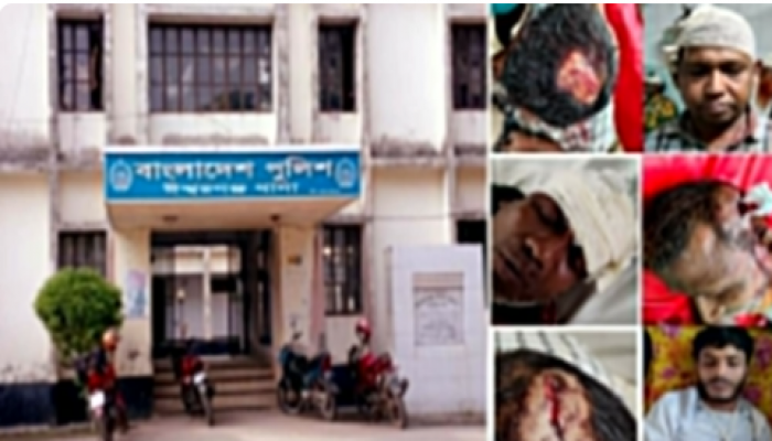 ​ বাড়ি ফেরার পথে প্রতিপক্ষের হামলায় আহত ১০, দুইজনের অবস্থা আশঙ্কাজনক