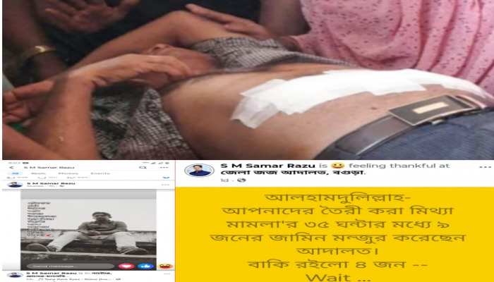 ​ঘা না শুকাতেই জামিনে মুক্তি" সান্তাহারে বিএনপি নেতাকে ছুরিকাঘাতে হত্যাচেষ্টা মামলায়; আতঙ্ক জনমনে