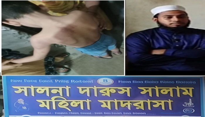 ‎গাজীপুরে ৭ বছরের শিশুকে লোহার স্কেল দিয়ে পিটিয়ে ও লাথি মেরে জখম করল মাদরাসা শিক্ষক