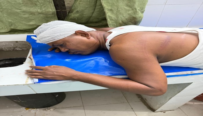 গৌরনদীতে সাবেক কাউন্সিলর লিটন বেপারীকে পিটিয়ে গুরুতর জখম