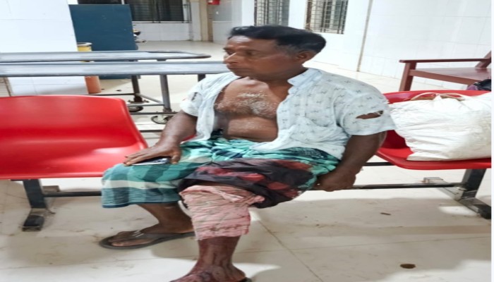 তানোরে জমি নিয়ে বিরোধের জেরে বর্গাচাষীকে হাতুড়ি দিয়ে পিটিয়ে পাঁ ভেঙ্গে দিয়েছে প্রতিপক্ষরা