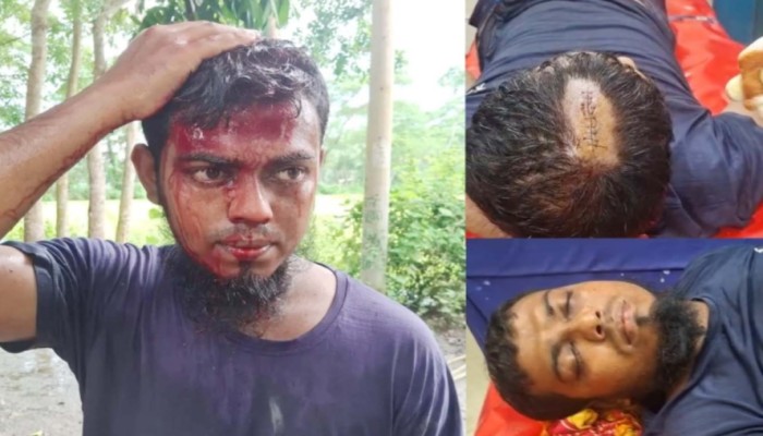 আগৈলঝাড়ায় হ'ত্যার উদ্দেশ্যে দেবর-ভাবীর ওপর হা'মলা, শ্লী'লতাহানীর অ'ভিযোগ