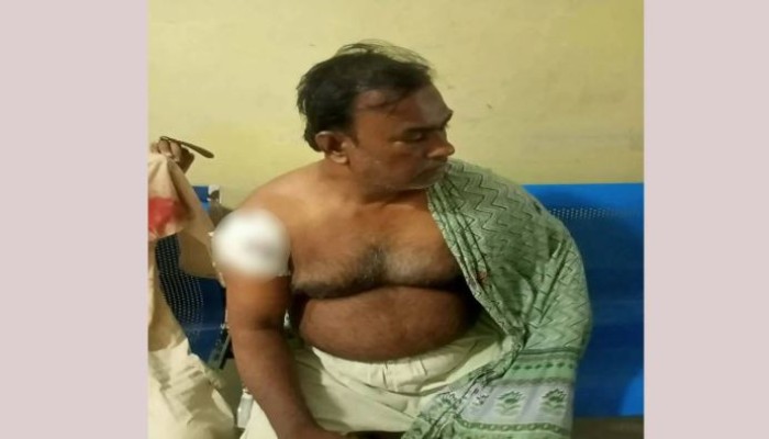 সন্দ্বীপে ব্যবসায়ী গু'লি'বি'দ্ধ